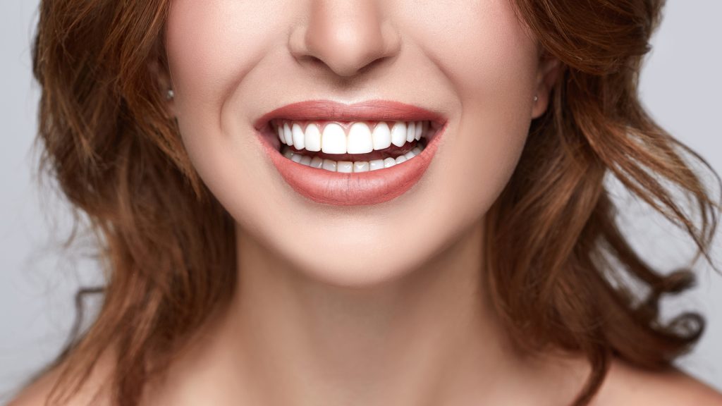 Soho Smile