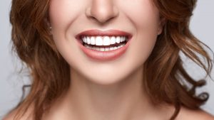 Soho Smile