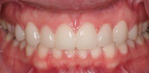 Gateway Dental Care