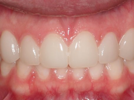 Gateway Dental Care