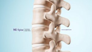 NU-Spine: The Minimally Invasive Spine Surgery Institute
