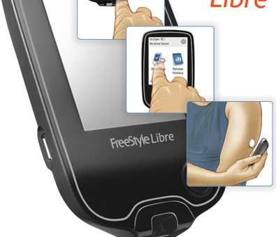 blood sugar monitor without finger pricks